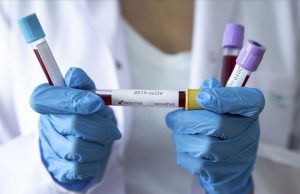Valneva в Британии проводит испытания вакцины от коронавируса