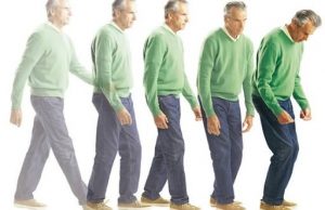 Потеря обоняния — один из симптомов болезни Паркинсона