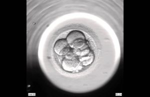 Ученые вырастили из клеток человеческой кожи эмбрион