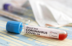 В РАН предлагают ввести штрафы за уклонение от вакцинации против коронавируса