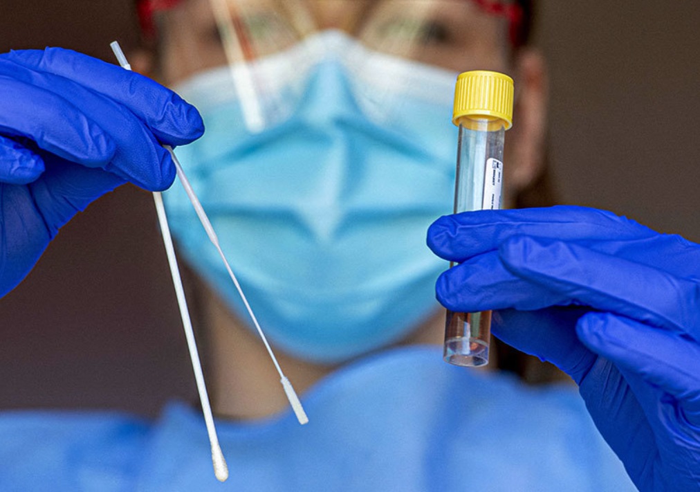В университете Аризоны обозначили первый в мире случай заражения коронавирусом