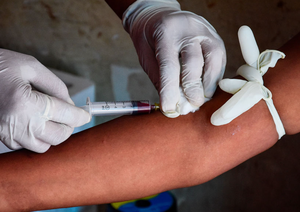 В США допущена к использованию профилактическая вакцина против ВИЧ